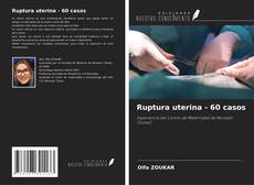 Обложка Ruptura uterina - 60 casos