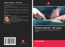 Couverture de Rutura uterina - 60 casos