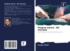 Copertina di Разрыв матки - 60 случаев