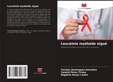 Leucémie myéloïde aiguë的封面