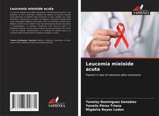 Leucemia mieloide acuta kitap kapağı