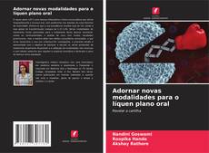 Bookcover of Adornar novas modalidades para o líquen plano oral