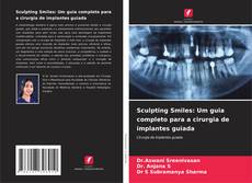 Обложка Sculpting Smiles: Um guia completo para a cirurgia de implantes guiada