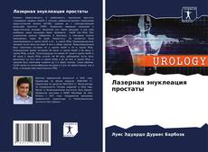 Bookcover of Лазерная энуклеация простаты