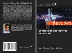 Couverture de Enucleación por láser de la próstata
