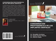 CONSIDERACIÓN PROSTODÓNCICA DE LOS IMPLANTES DENTALES kitap kapağı