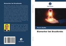 Biomarker bei Brustkrebs kitap kapağı