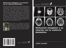 Buchcover von Disfunción amigdalar y su relación con la violencia doméstica
