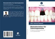 Biomaterialien für Zahnimplantate的封面