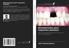 Обложка Biomateriales para implantes dentales