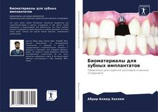 Bookcover of Биоматериалы для зубных имплантатов