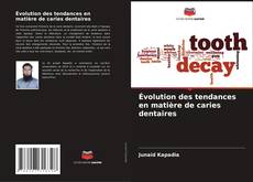 Bookcover of Évolution des tendances en matière de caries dentaires