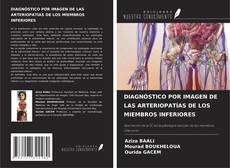 Bookcover of DIAGNÓSTICO POR IMAGEN DE LAS ARTERIOPATÍAS DE LOS MIEMBROS INFERIORES