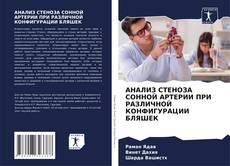 Borítókép a  АНАЛИЗ СТЕНОЗА СОННОЙ АРТЕРИИ ПРИ РАЗЛИЧНОЙ КОНФИГУРАЦИИ БЛЯШЕК - hoz