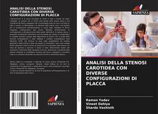 Bookcover of ANALISI DELLA STENOSI CAROTIDEA CON DIVERSE CONFIGURAZIONI DI PLACCA