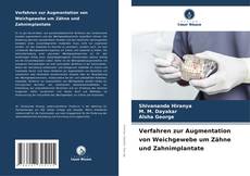 Bookcover of Verfahren zur Augmentation von Weichgewebe um Zähne und Zahnimplantate