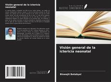 Bookcover of Visión general de la ictericia neonatal