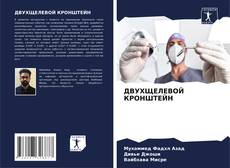 Buchcover von ДВУХЩЕЛЕВОЙ КРОНШТЕЙН