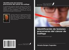 Bookcover of Identificación de lesiones precursoras del cáncer de esófago