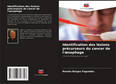 Buchcover von Identification des lésions précurseurs du cancer de l'œsophage