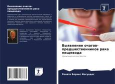 Bookcover of Выявление очагов-предшественников рака пищевода