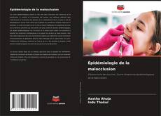 Buchcover von Épidémiologie de la malocclusion