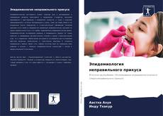 Buchcover von Эпидемиология неправильного прикуса