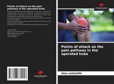 Capa do livro de Points of attack on the pain pathway in the operated knee 