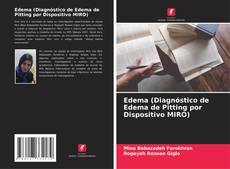 Buchcover von Edema (Diagnóstico de Edema de Pitting por Dispositivo MIRO)