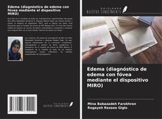 Edema (diagnóstico de edema con fóvea mediante el dispositivo MIRO) kitap kapağı
