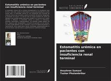 Bookcover of Estomatitis urémica en pacientes con insuficiencia renal terminal