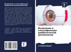 Обложка Выявление и классификация диабетической ретинопатии