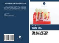 Capa do livro de PERIIMPLANTÄRE ERKRANKUNGEN 