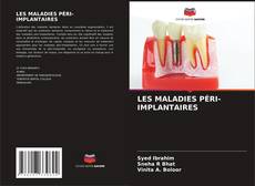LES MALADIES PÉRI-IMPLANTAIRES的封面