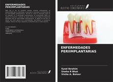 Bookcover of ENFERMEDADES PERIIMPLANTARIAS