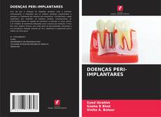 Buchcover von DOENÇAS PERI-IMPLANTARES