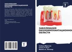 Bookcover of ЗАБОЛЕВАНИЯ ОКОЛОИМПЛАНТАЦИОННОЙ ОБЛАСТИ