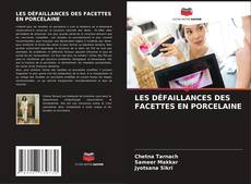 LES DÉFAILLANCES DES FACETTES EN PORCELAINE的封面