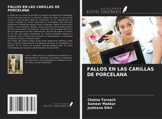 FALLOS EN LAS CARILLAS DE PORCELANA kitap kapağı