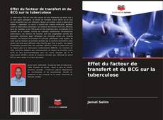 Couverture de Effet du facteur de transfert et du BCG sur la tuberculose