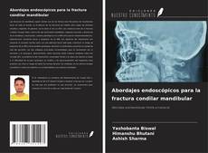 Capa do livro de Abordajes endoscópicos para la fractura condilar mandibular 