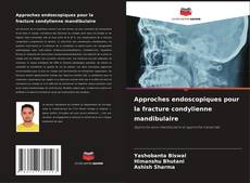 Capa do livro de Approches endoscopiques pour la fracture condylienne mandibulaire 