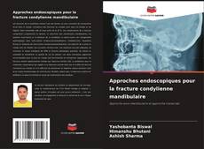 Bookcover of Approches endoscopiques pour la fracture condylienne mandibulaire