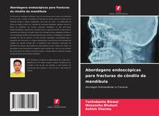 Copertina di Abordagens endoscópicas para fracturas do côndilo da mandíbula