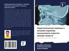 Bookcover of Эндоскопические подходы к лечению перелома мыщелкового отростка нижней челюсти