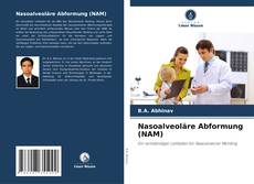 Bookcover of Nasoalveoläre Abformung (NAM)