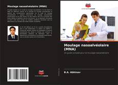 Moulage nasoalvéolaire (MNA) kitap kapağı