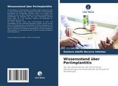 Bookcover of Wissensstand über Periimplantitis