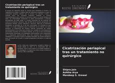 Bookcover of Cicatrización periapical tras un tratamiento no quirúrgico
