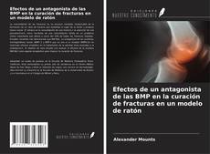 Capa do livro de Efectos de un antagonista de las BMP en la curación de fracturas en un modelo de ratón 